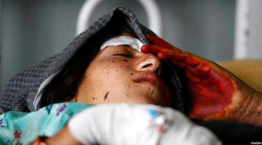 یکی از بانوان قربانی خشونت در افغانستان