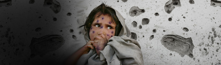 قربانیان بی‌گناه جنگ؛ تاکید بر حفاظت از کودکان در افغانستان