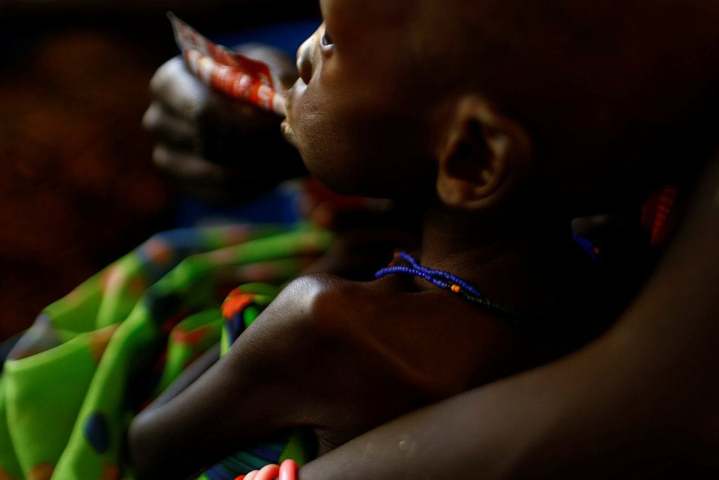مادر در حال غذا دادن به پسرش در یکی از شفاخانه های تحت حمایت یونیسف (UNICEF) در سودان جنوبی. تصویر از رویترز