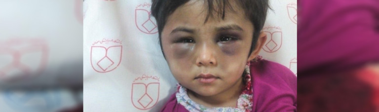 شکنجه شوکه آور دختر 4 ساله افغان در ایران