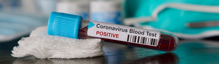 580 مورد جدید ابتلا به کرونا ویروس؛ وزارت صحت: اوضاع وخیم شده است