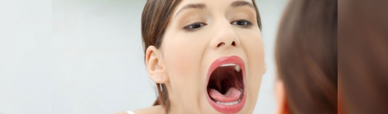 تشخیص بیماری از روی زبان :۸ اختلال و بیماری که از روی زبان قابل تشخیص است