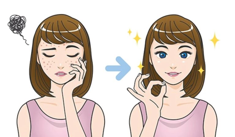 درمان های خانگی برای از بین بردن لکه های تیره روی صورت