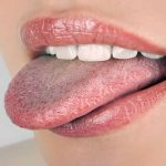 11 درمان خانگی برای سفید شدن زبان و نکات پیشگیری از آن