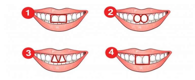 شکل دندان های شما چه چیزی در مورد شخصیت تان می گوید؟