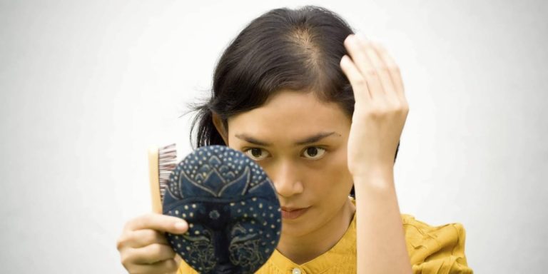 ریزش مو در نوجوانی؛ دلایل بروز این مشکل و راهکارهای رفع آن
