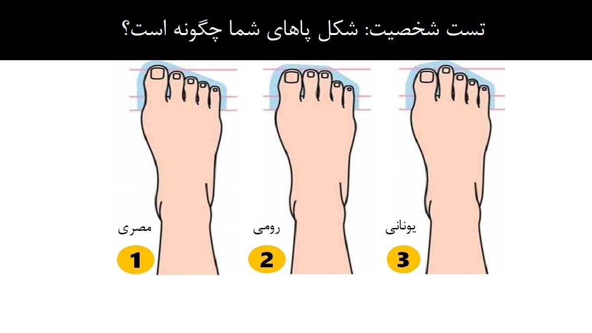 شکل پاهای شما چگونه است؟