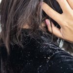 آیا روغن زدن به مو، باعث افزایش شوره سر می شود؟
