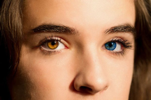 هتروکرومیا: چرا رنگ چشم برخی از افراد با هم فرق دارند؟