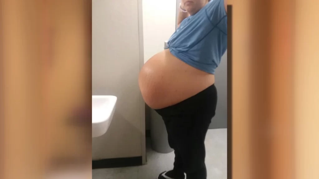 بزرگترین شکم بارداری جهان