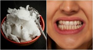 سفید کردن دندان با روغن نارگیل؛ آیا این روش واقعا اثرگذار است؟