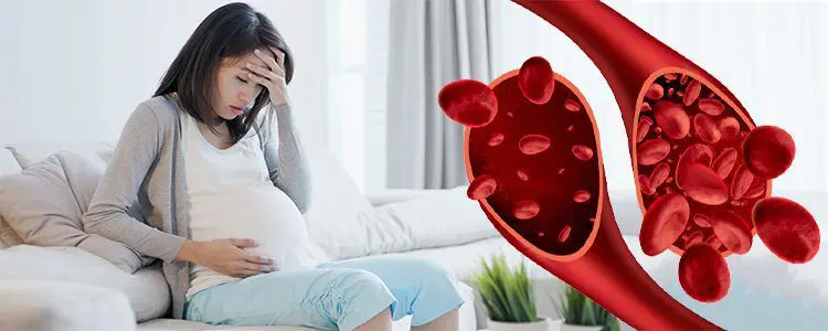 کم خونی در بارداری