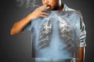 یافته های جدید: پزشکان از نحوه ترمیم ریه های افراد سیگاری می‌گویند!