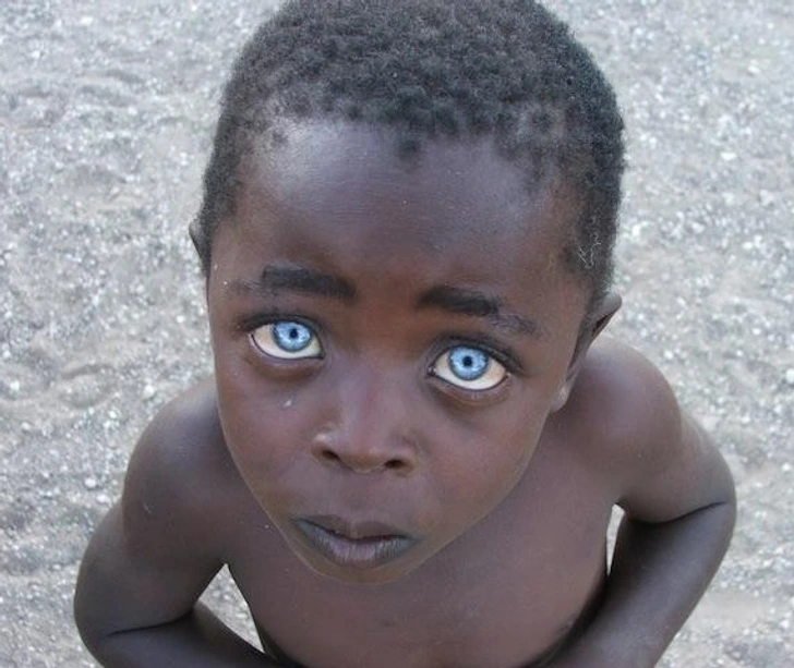 جذابترین کودکان دنیا- این پسربچه نادرترین ژن چشم را دارد، چشمان او واقعا شگفت انگیز است