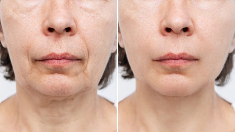 با ۱۰ راهکار افتادگی پوست صورت و گردن را درمان کنید