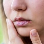 رفع تبخال در سه دقیقه