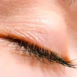 علت پریدن پلک چشم چپ: علل، تشخیص و درمان