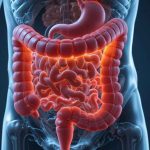 نشانه های اولیه سرطان روده