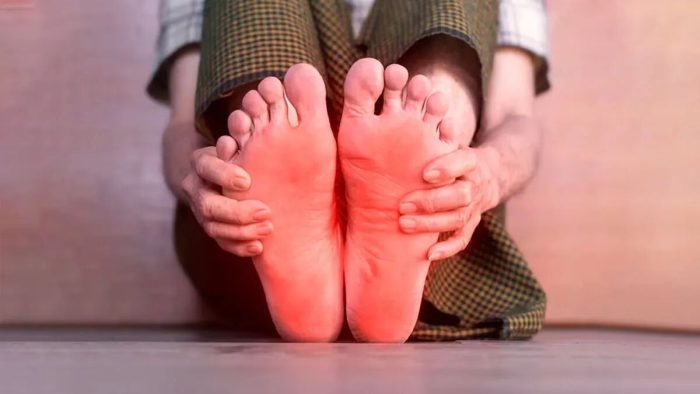 قارچ پوستی و عفونت‌ها